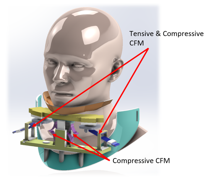 CFM-based Neck Brace项目发布审核